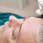 Modern Hair Transplants