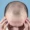Can I Regrow My Receding Hairline