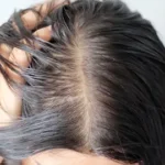 Can Your Thin Hair Become Thick Again