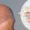 Before and after results of male hair restoration – Can a man really get his hair back with FUE or PRP treatment in Islamabad?