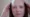 HRT and hair loss in women