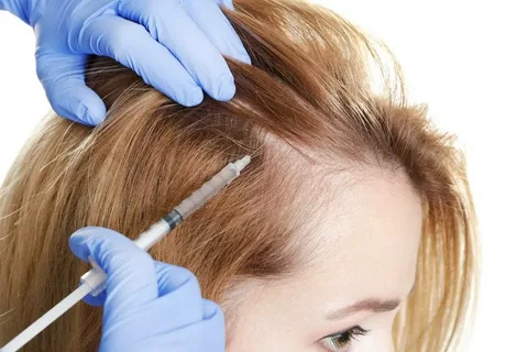 PRP Hair Loss Near Me