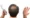 How Can Men Regrow Thinning Hair