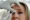 How hairy moles could lead to a new Botox
