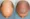 Is It Possible to Grow Back Thinning Hair