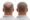 Is balding at 25 normal?