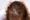 Hair Loss Practitioner