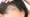Why is my hair thinning at 18 (female)