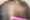 Why Is My Hair Thinning at 18 (Female)