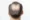 Why is my hair thinning at 18 (male)?