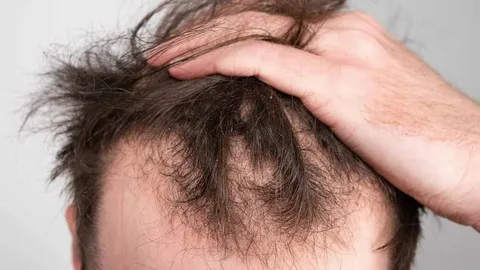 Expert Dermatologist for Alopecia