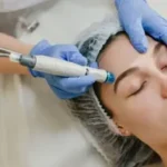 benefits of monthly HydraFacial