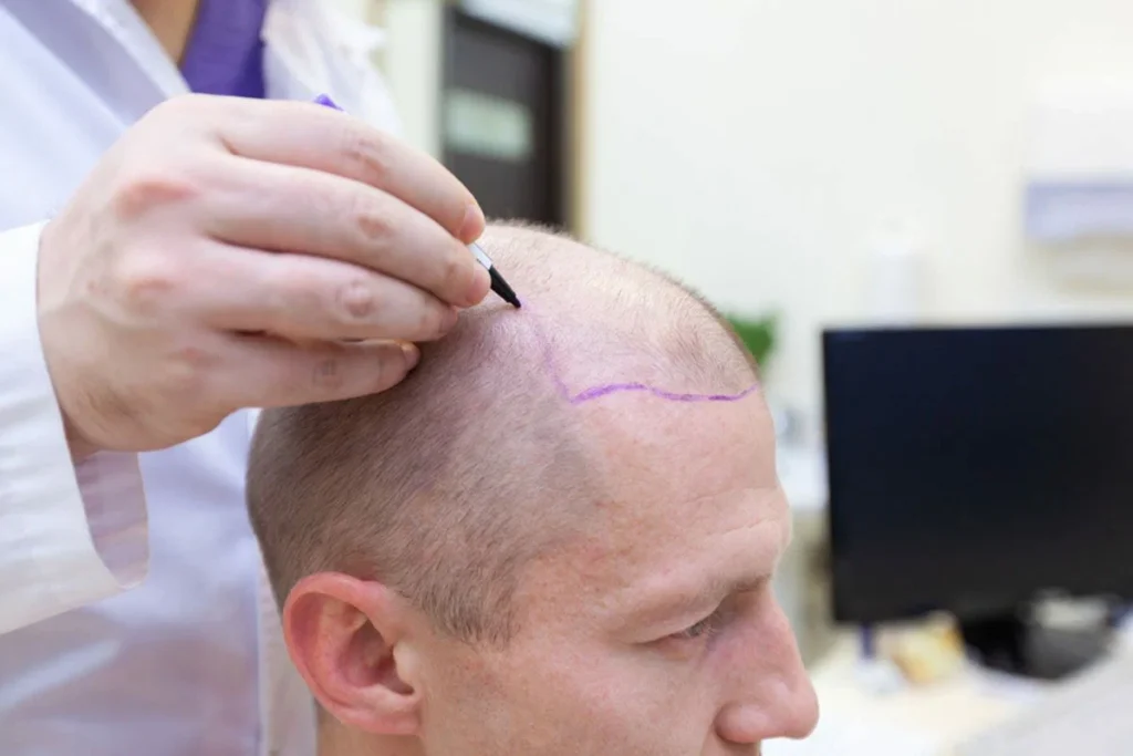 does thin hair grow back