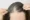 does thin hair grow back