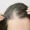 does thin hair grow back