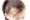 does thin hair grow back?