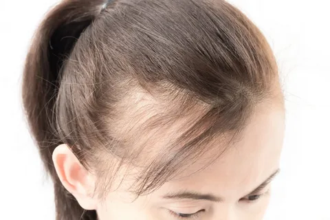 does thin hair grow back?