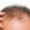 Person experiencing hair thinning, exploring the effects of glutathione hair loss and regrowth