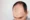 glutathione hair loss