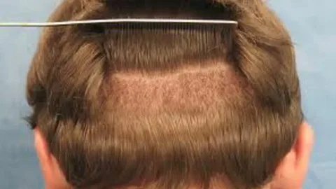 when will hair cloning be available to the public