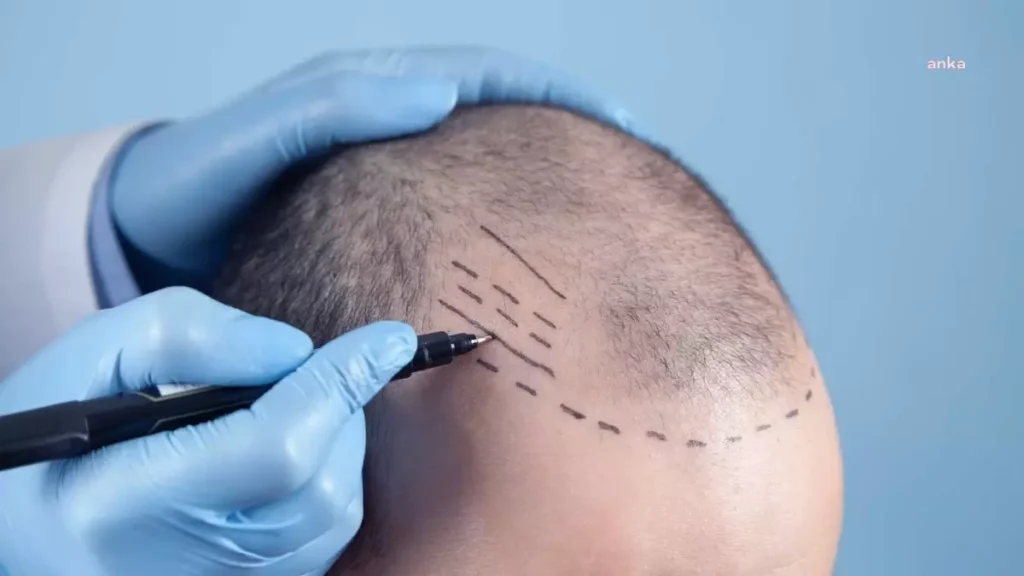 Revolutionary Solutions for Hair Loss