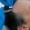 hormone replacement and hair loss