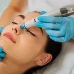 how long do benefits of hydrafacial last