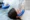 how to stop hair loss after anesthesia