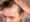 how to stop receding hairline