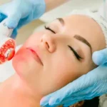 infrared light benefits skin with HydraFacial