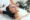 HydraFacial benefits for pigmentation