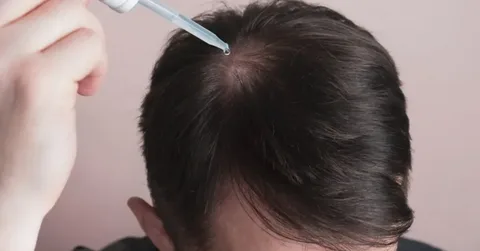 potential side effects of hair cloning