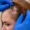 how do you get tested for alopecia