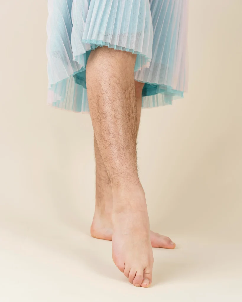 hair loss on shins