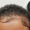 Does Edge Control Cause Hair Loss