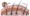 Transformative Solutions for Hair Loss