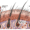 Transformative Solutions for Hair Loss