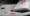 Does Hemochromatosis Cause Hair Loss