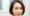 Botox for Hair Loss