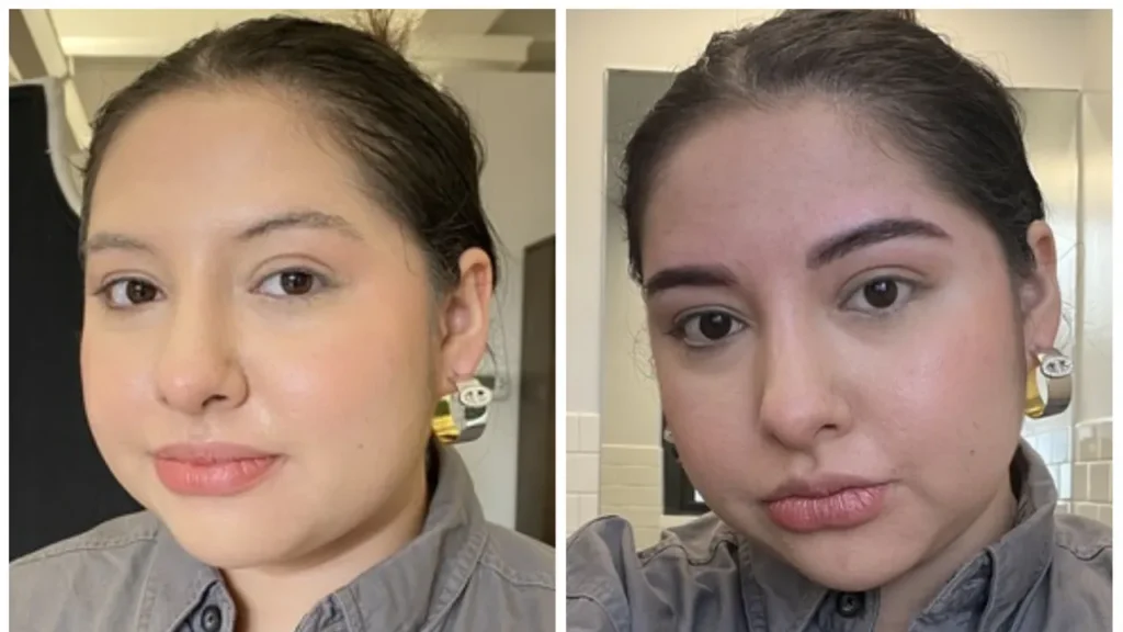 Hair Loss Microblading