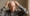 can diabetes make you lose hair