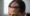 Mold Exposure Hair Loss