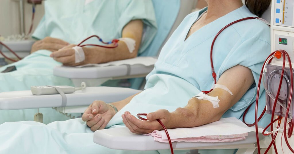 Dialysis and Hair Loss