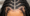 Braids and Hair Loss