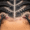 Braids and Hair Loss