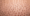 hair transplant donor area regrowth