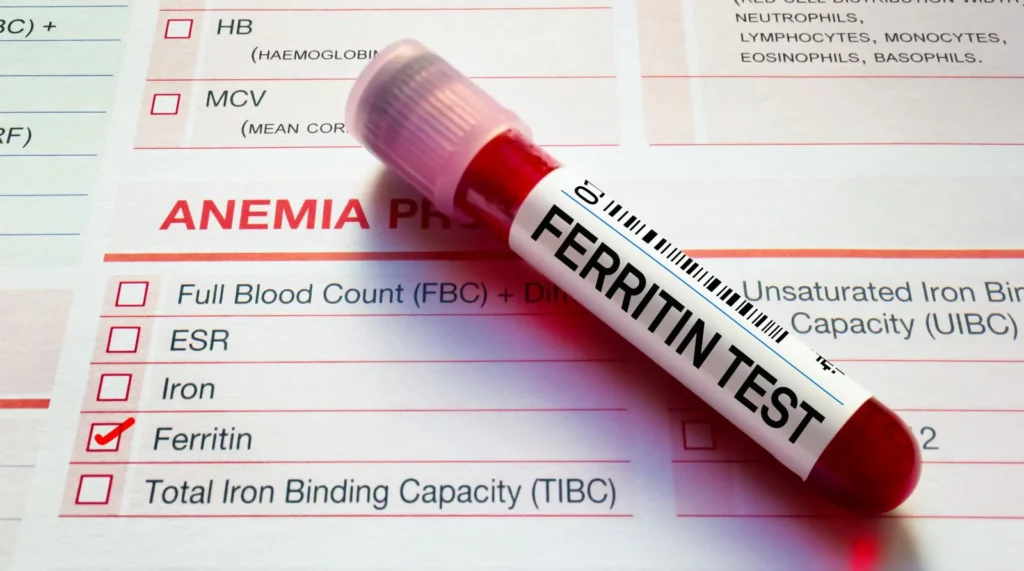 Can High Ferritin Cause Hair Loss
