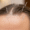 Acupuncture for Hair Loss