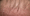 Can Dry Scalp Lead to Hair Loss