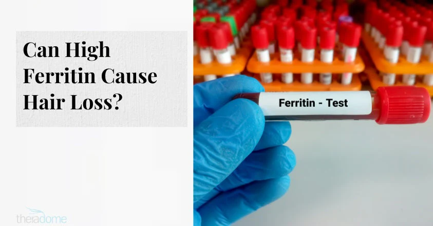 Can High Ferritin Cause Hair Loss